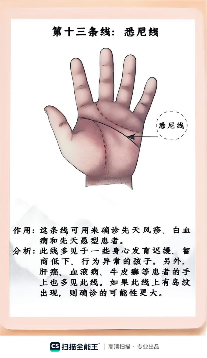 第36张